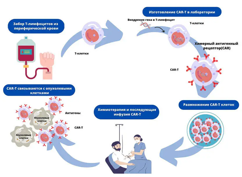 CAR-T-клеточная терапия - этапы лечения