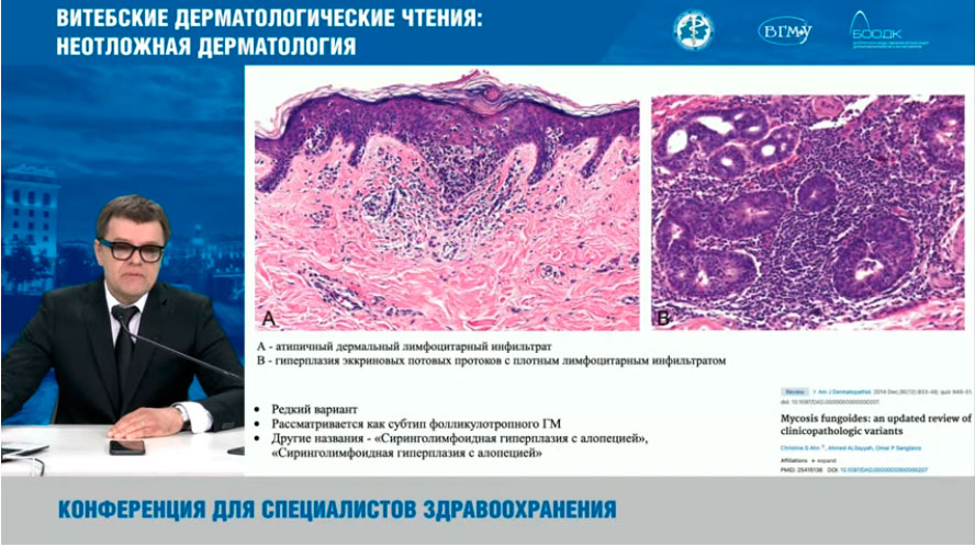 vitebskie dermatologicheskie chteniya neotlozhnaya dermatologiya 3