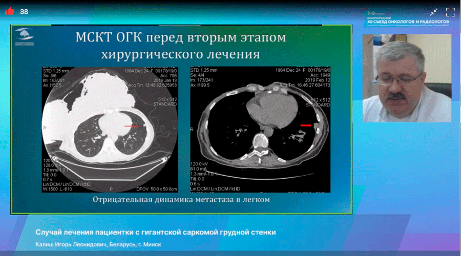 s ezd onkologov i radiologov stran sng i evrazii 7