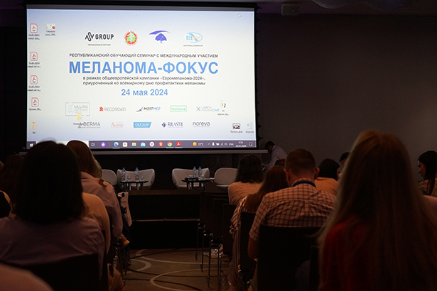 melanoma fokus 02