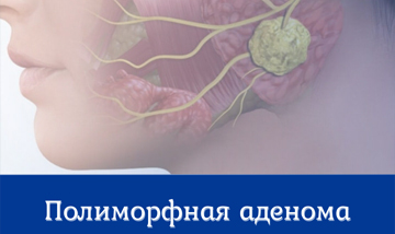 Polimorfnaya Adenoma 0