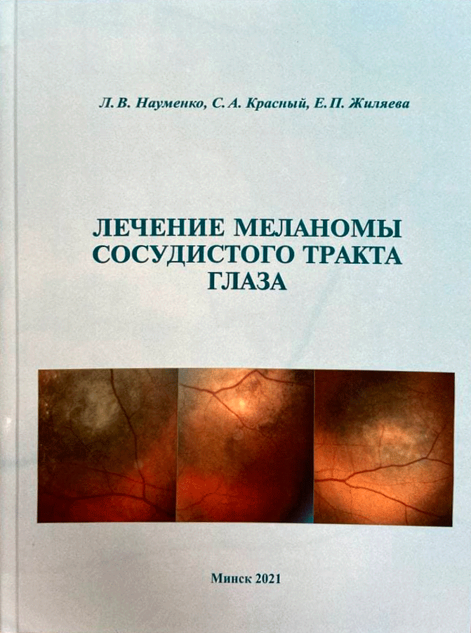 onkooftalmologiya update 2
