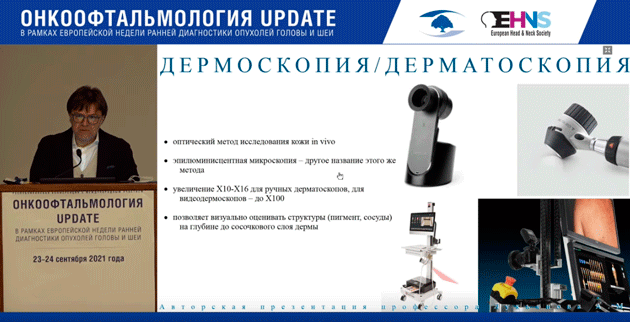 onkooftalmologiya update 6