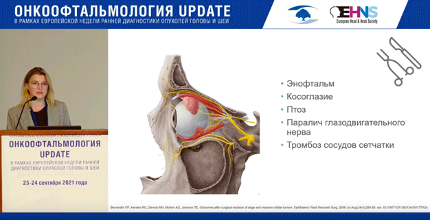 onkooftalmologiya update 8