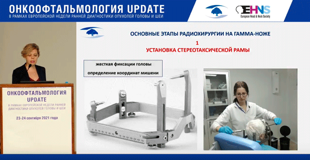 onkooftalmologiya update 9