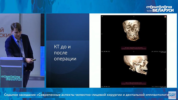 viii belorusskij mezhdunarodnyj stomatologicheskij kongress 2