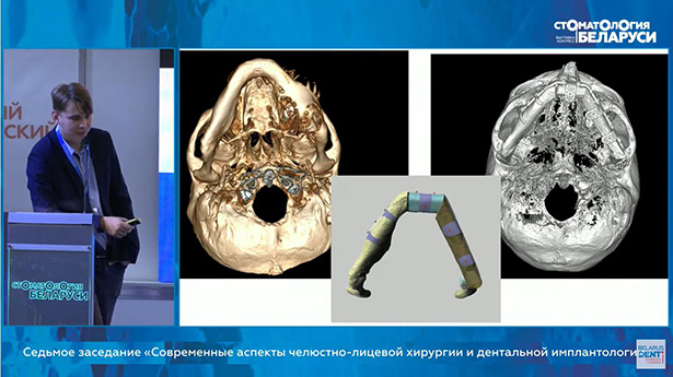 viii belorusskij mezhdunarodnyj stomatologicheskij kongress 3